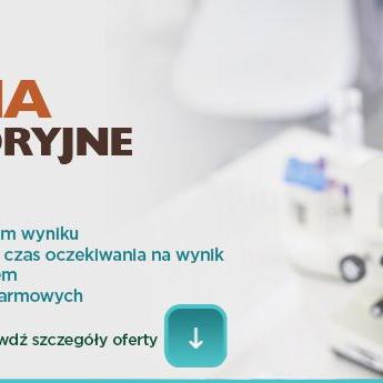 Insulina po 2 godz.