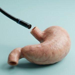 Gastroskopia z testem ureazowym w znieczuleniu ogólnym