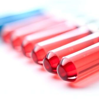Glucose after 75g glucose – 1h measurement