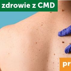 Videodermatoscopy + consultation with a dermatologist