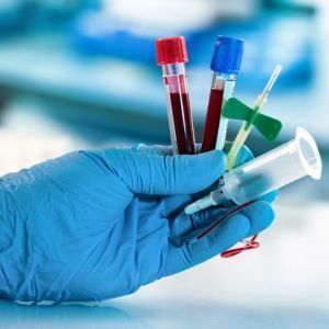 Test package - HIV prevention (PEP)