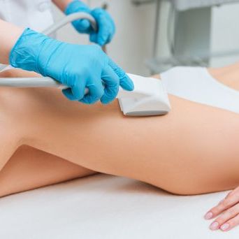 Pakiet 3 zabiegów epilacji laserowej – uda (dla pań)