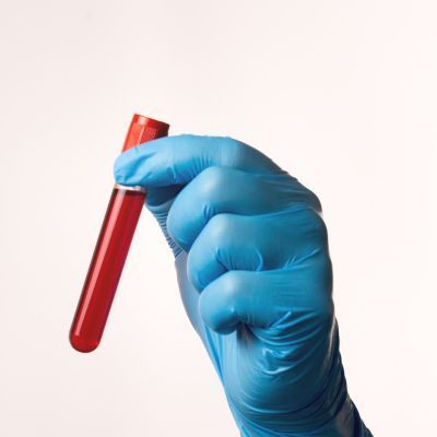 Fasting iron – serum