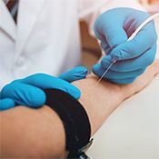 EMG - examination of the nerve in ulnar groove syndrome