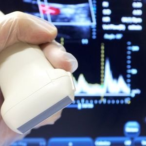 Doppler ultrasound of intracranial arteries