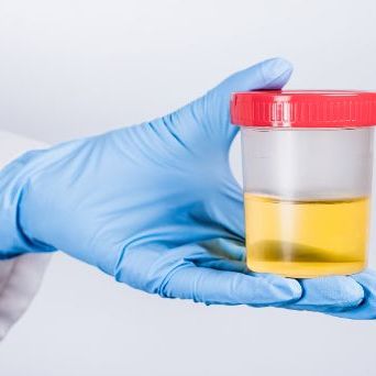 General urine analysis