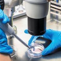 Pakiet badań - ryzyko cukrzycy