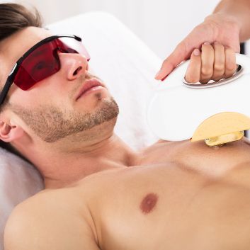 Package of 3 laser epilation treatments - chest (for men)