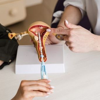 Insertion of an intrauterine device (IUD)