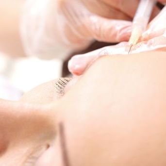 Platelet-rich plasma - large