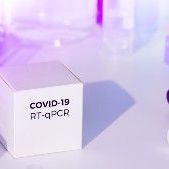 Swab for SARS-CoV-2 by RT-PCR at the Blood Drawing Station