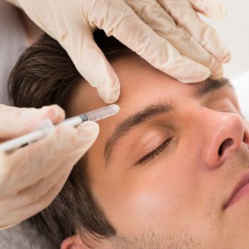 Botulinum toxin Botox/Vistabel treatment for hyperhidrosis of the forehead
