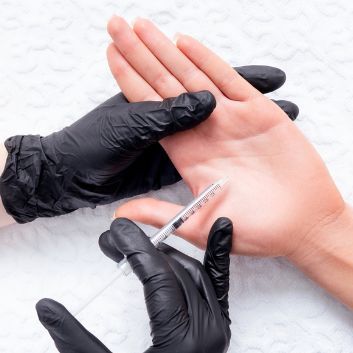 Botulinum toxin botox/vistabel - treatment of hyperhidrosis of the hands