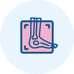 Rtg stopy AP + boczne