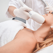 Laser depilation (epilation) of the cheeks and chin