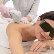 Laser depilation (epilation) of the arms