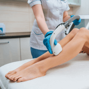 Laser depilation (epilation) of the calves for women