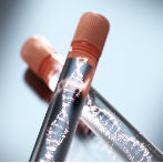 Ovarian reserve - AMH hormone